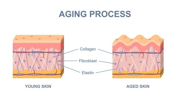 Skin aging process. Changes structure of elastin, collagen and fibroblasts in aged and young skin. Infographics for cosmetology about age related and vitamins. Cartoon flat vector illustration